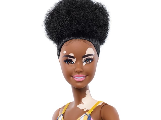 Barbie doll with the skin condition vitiligo