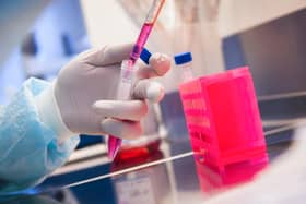 A scientist working on a coronavirus vaccine says it could be ready as soon as autumn