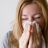 Sinusitis