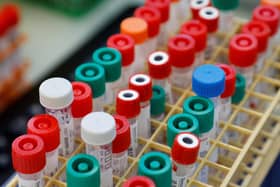 The rate of coronavirus infections across England and Wales appears to be slowing down