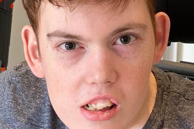 Max Kerekes, who suffers from a severe form of epilepsy called Dravet Syndrome