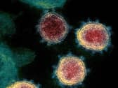 First cases of worrying Manaus variant of Covid-19 found in UK