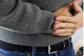 Irritable bowel syndrome