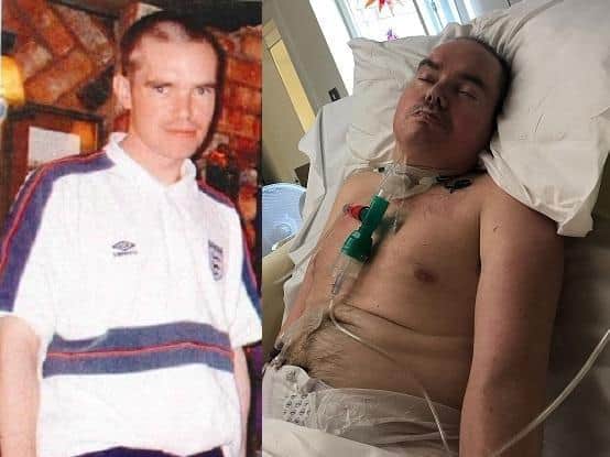 Alec's family wanted to publish these photos of him; one before the assault in February 2007, and the other as he was treated in his last days of life, to illustrate the effect of such a violent act. (Credit: Lancashire Police)
