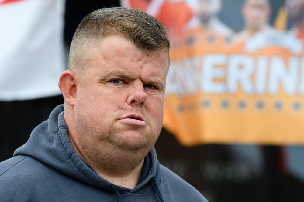 Ryan Smith is worried that the small cancerous carcinoma growths under his eye are growing and will cause similar problems he had previously, if left too long