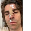 Liam Gallagher says he fell out of a helicopter