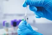 STI testing