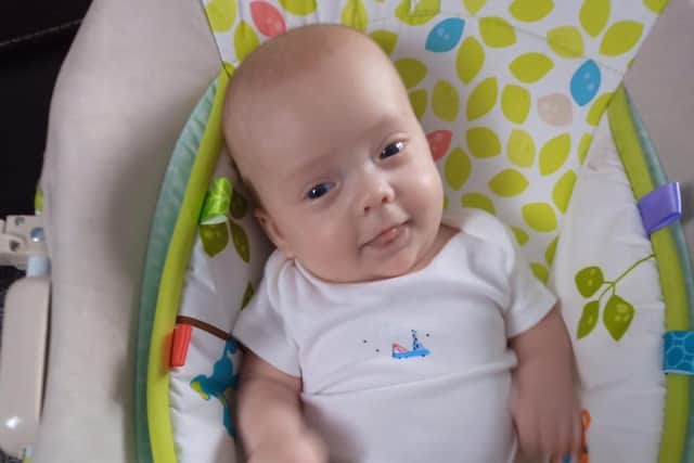 Little Hudson Freeman was born with spina bifida and hydracephalus