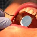 Checking condition of teeth with a visit to the dentist