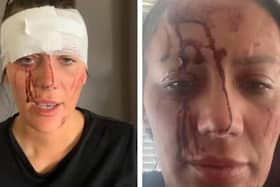 The family of Kiena Dawes released these images of the 23-year-old and claimed she suffered a number of violent assaults before her tragic suicide on the railway line in Garstang in July 2022