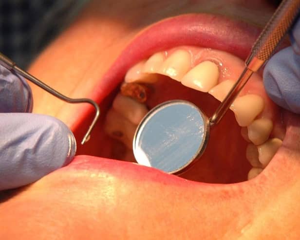 Many people have been forced to visit A&E due to sore teeth