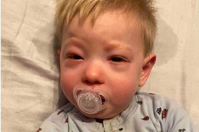 Konrad Brett who stops breathing and chokes on his tonsils because they are too big has been denied life-changing surgery for at least another year.