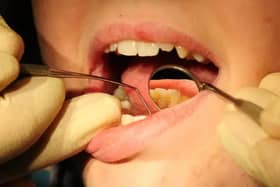 Thousands missed out on dental appointments during pandemic