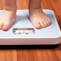 Child obesity action call.