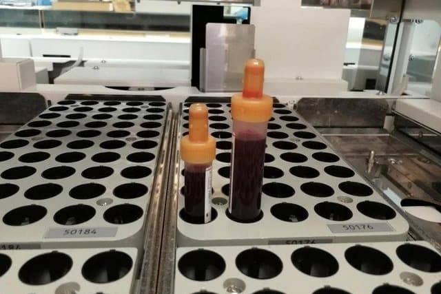 Urgent blood tests would still be analysed at hospital sites under the plans - but routine work would be carried out at a base in Samlesbury