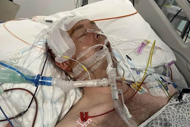 Lee had to undergo a three-hour operation at Royal Preston Hospital with surgeons having to remove part of his skull and brain to save his life