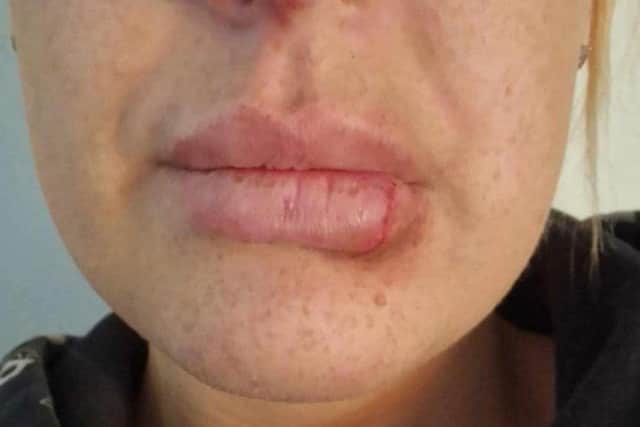 Miranda has now spoken out about her ordeal and is encouraging other domestic abuse victims to come forward and get the help they deserve