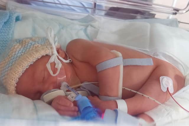 Little Hudson Freeman was born premature at Blackpool Victoria Hospital, where staff have been praised