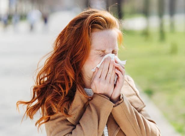 Photo of woman with hayfever symptoms sneezing