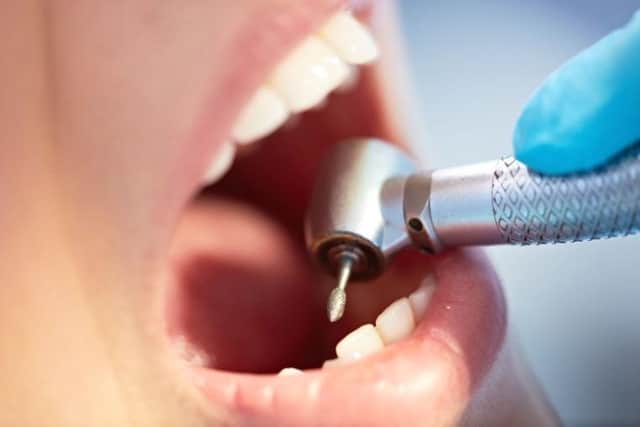 Concerns have been raised about the state of NHS dentistry in England and Wales
