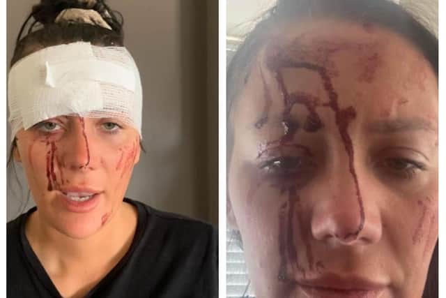 The family of Kiena Dawes have released these images of the 23-year-old appearing to show her suffering a graphic head injury
