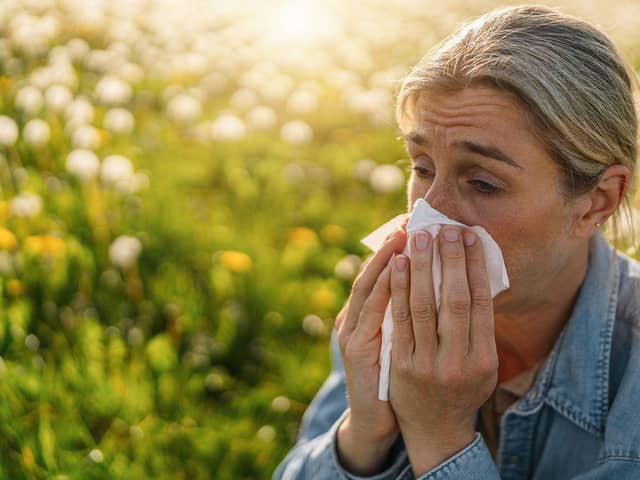 Sneezing and itchy eyes are common symptoms of hay fever