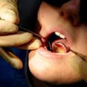 The number of people seeing an NHS dentist in Lancashire in the past two years has fallen sharply - from just under two thirds to just over a third
