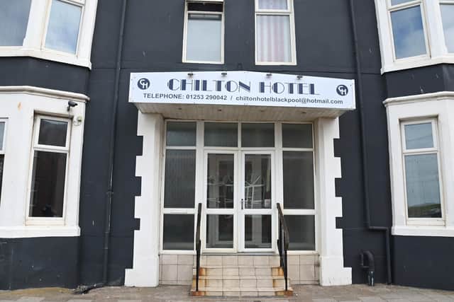 Deepak owns three hotels in Blackpool, but only runs one of them- of The Chilton Hotel.