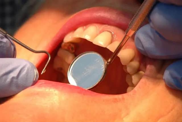 Children in Blackpool have some of the worst teeth in England