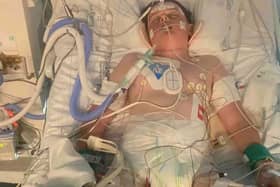 Jack is currently on a ventilator in the Intensive Care Unit at Son Espasse Hospital in Majorca as his lungs are not strong enough for him to breath on his own
