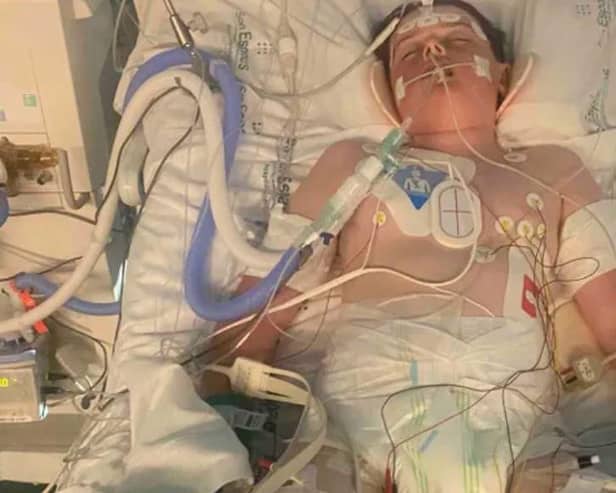 Jack is currently on a ventilator in the Intensive Care Unit at Son Espasse Hospital in Majorca as his lungs are not strong enough for him to breath on his own