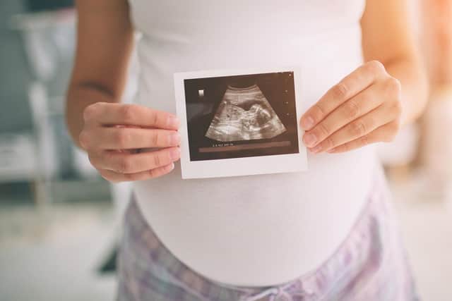 Generic photo of a pregnant woman and scan photo