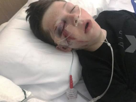 Jack Beckett was left with a series of serious injuries after falling from a funfair ride visiting Poulton as part of the towns gala celebrations last year