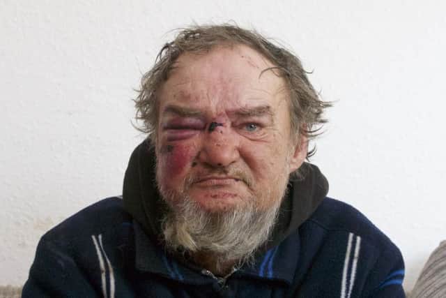 Igor Gieci was attacked in the early hours of yesterday, and well-wishers and good Samaritans now want to help him