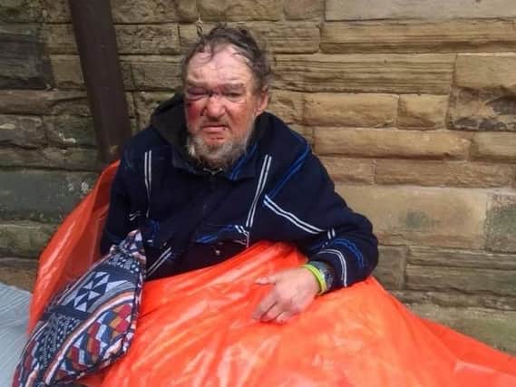 Igor was attacked as he slept in his tent on the Promenade at Blackpool (Picture: Mark Butcher/Facebook)