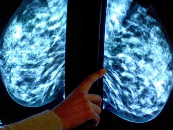 A mammogram check for breast cancer. Picture by PA Archive/PA Images