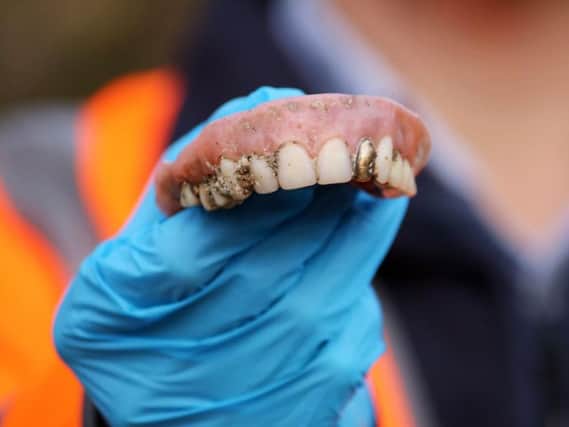 Set of false teeth found at the firm's water recycling centre in Bristol. Photo credit: Wessex Water/PA Wire