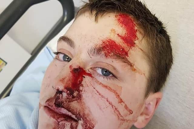 Conner Bluck, 12, was seriously hurt in a hit and run in Blackpool on Thursday December 6.