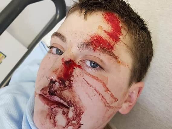 Conner Bluck, 12, was seriously hurt in a hit and run in Blackpool on Thursday December 6.