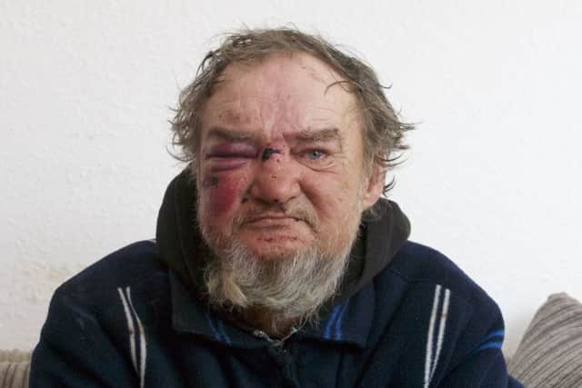 Igor Gieci was left battered and bruised after being attacked by three teenagers as he slept in a tent on the Promenade in Blackpool