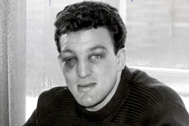 Brian London on January 13th 1959, 24 hours after his fight with Henry Cooper.