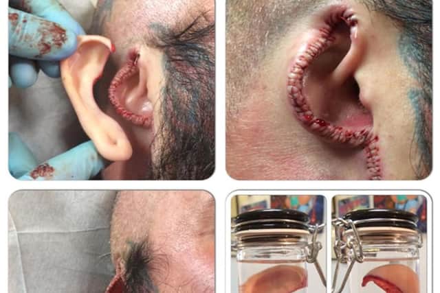An ear cut off from a customer of tattooist Brendan McCarthy, 50, from Bushbury, Wolverhampton, who ran Dr Evil's Body Modification Emporium in Wolverhampton and who appeared at Wolverhampton Crown Court on Tuesday where he admitted causing grievous bodily harm to three customers by carrying out a tongue-splitting procedure and removing an ear and a nipple.