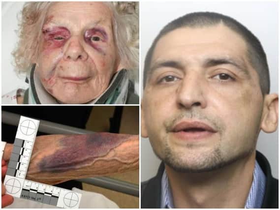 (Top left, bottom left: Injuries to Zofija Kaczan after an attack by (right) Artur Waszkiewicz