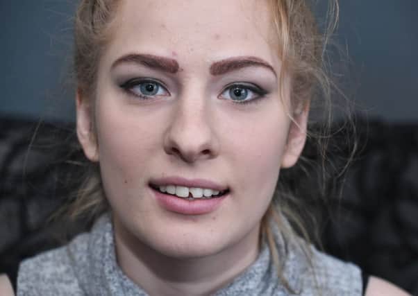 Picture by Julian Brown 23/02/19

Enia Iwachow who broke her front tooth on a kebab she got from a takeaway in Blackpool.