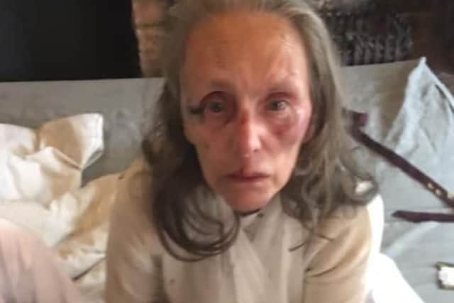 Lynne Whitworth, 65, suffered a broken arm after she was attacked in Dickson Road, Blackpool at around 11pm on Wednesday (June 19)