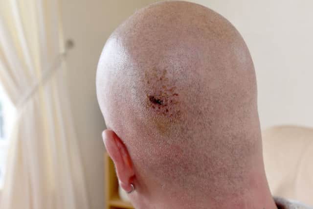 David Fennell was walking home with partner Paul Leighton when he was knocked unconscious in an unprovoked attack on Central Drive