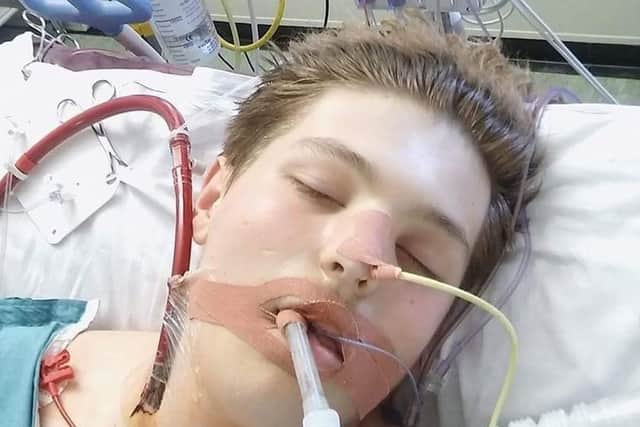 Ewan Fisher, 18, who was treated for hypersensitivity pneumonitis at Glenfield Hospital in Leicester