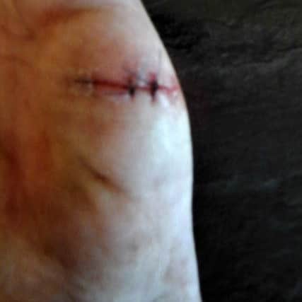 Terrence McMahon suffered nasty gashes to his hand as he protected himself from a vicious knife attack.