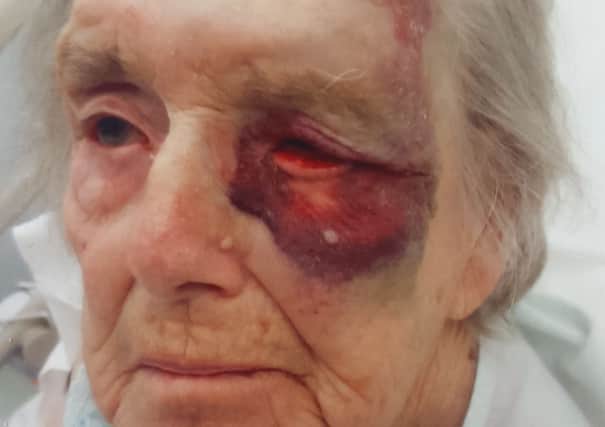 Gladys Millard, 89, was hurt in a fall at St Stephen's Nursing Home in Blackpool.