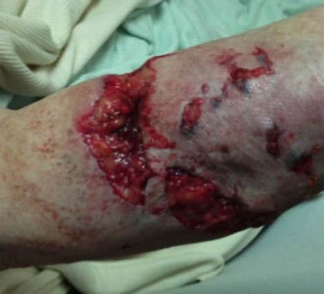 GRAPHIC CONTENT: The injuries suffered by the pensioner